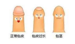 包皮手术 视频,专业视频带你了解手术细节